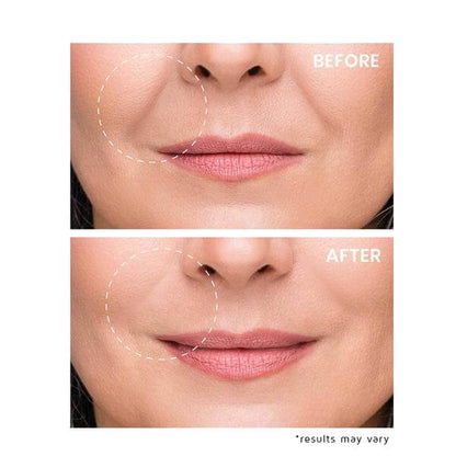 Microneedling Eye Patches by Yuvy