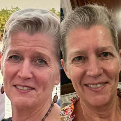 NuSkin™ - Take Back Your Skin's Youthful Appearance