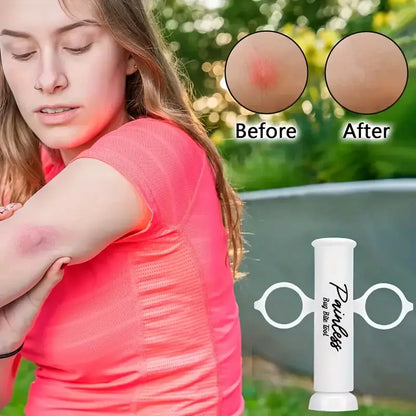 Bug Bite Tool™ - The Natural Solution That Brings Instant Relief