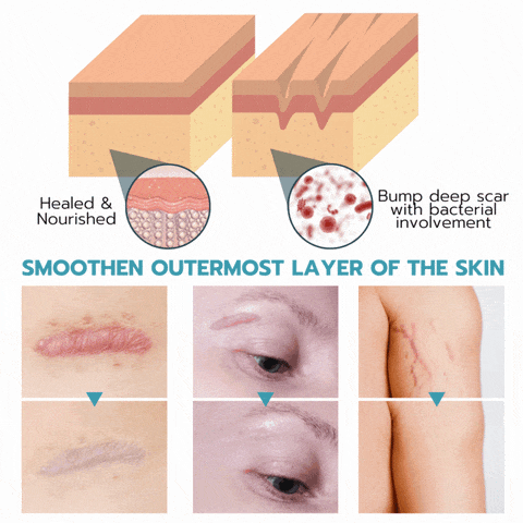 NuSkin™ - Take Back Your Skin's Youthful Appearance