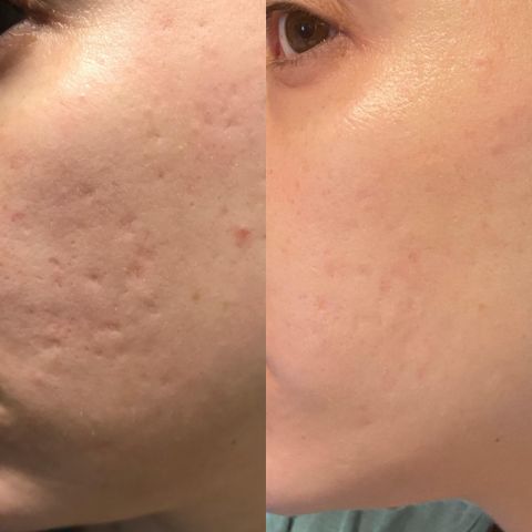 NuSkin™ - Take Back Your Skin's Youthful Appearance
