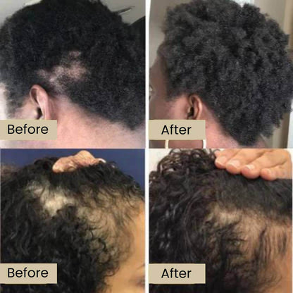 Eelhoe™ Natural Rosemary Hair Oil for Unmatched Confidence