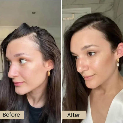 Eelhoe™ Natural Rosemary Hair Oil for Unmatched Confidence