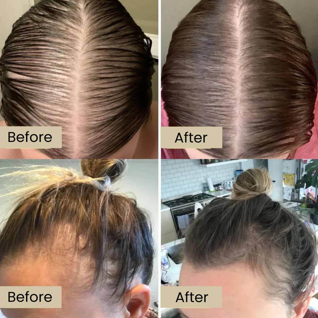 Eelhoe™ Natural Rosemary Hair Oil for Unmatched Confidence