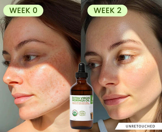 100% Pure Moringa Oil for Naturally Radiant Skin & Hair!